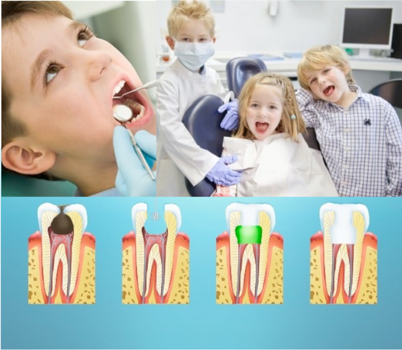 Лечение молочных зубов в красноярске