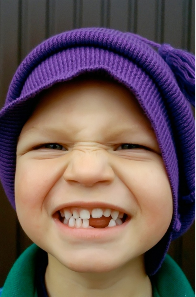 Лечение зубов детям в зубофф красноярск thumbnail